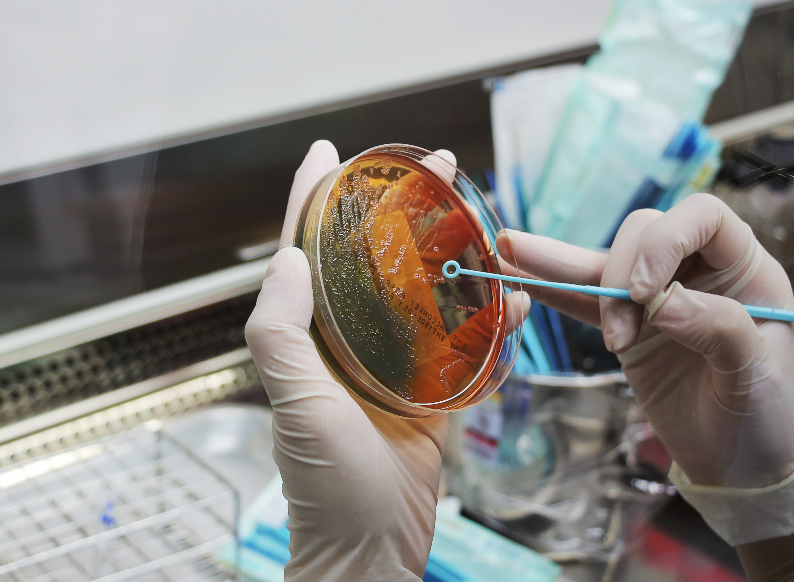 Scientists are holding a bacterial culture plate. Scientists are holding a bacterial culture plate.